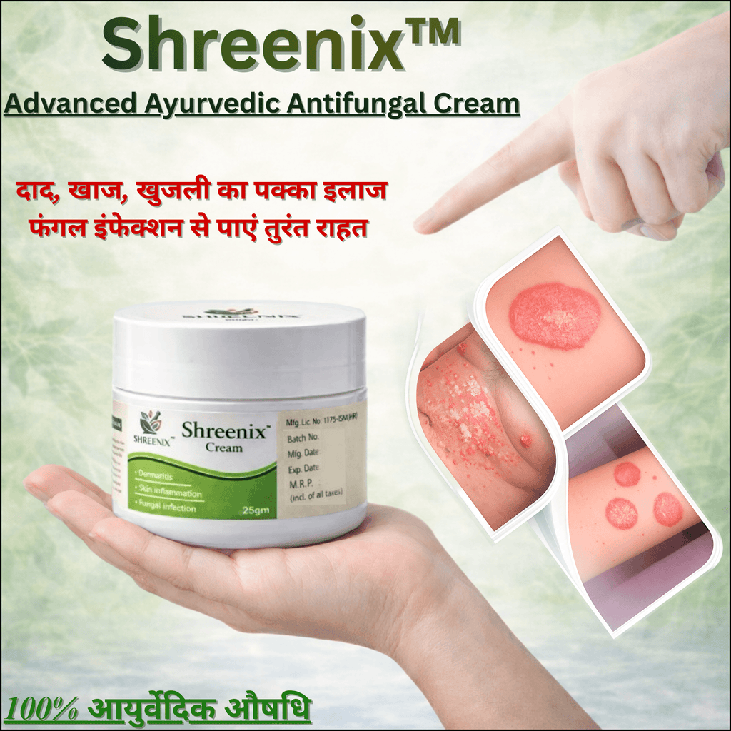 Shreenix Ayurvedic Antifungal Medicine: Natural Solution for Fungal Infection and Daad Relief