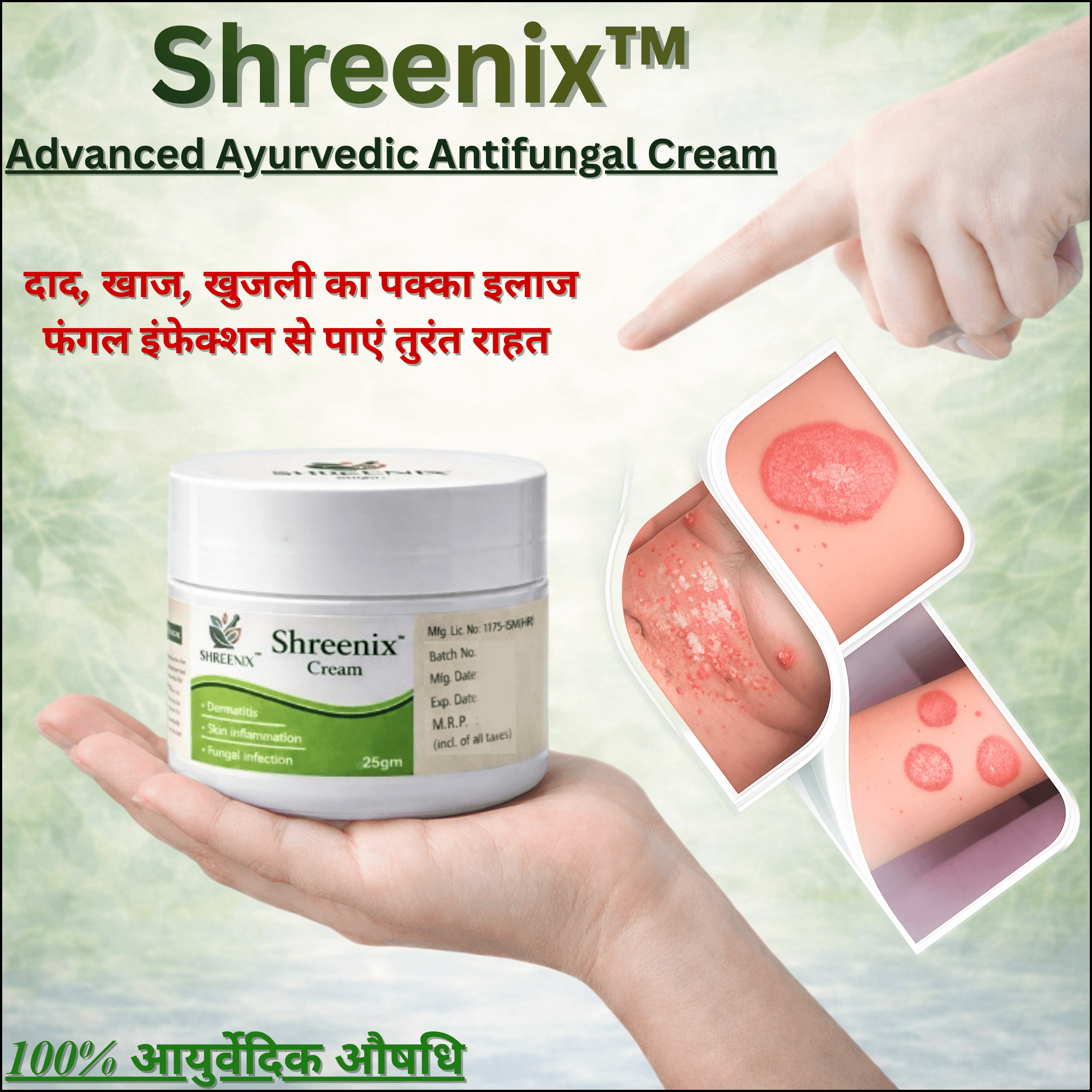 Shreenix Ayurvedic Antifungal Medicine: Natural Solution for Fungal Infection and Daad Relief